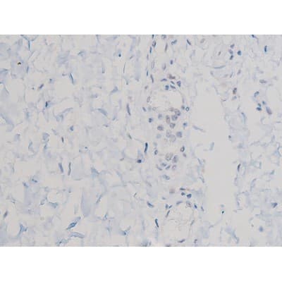 AKT1 Antibody (phospho-Thr450)