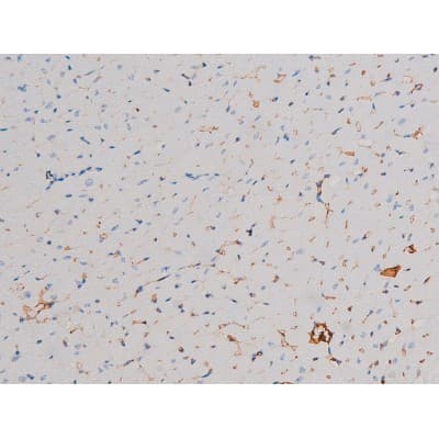 AKT1 Antibody (phospho-Thr450)