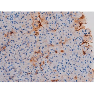AKT1 Antibody (phospho-Thr450)