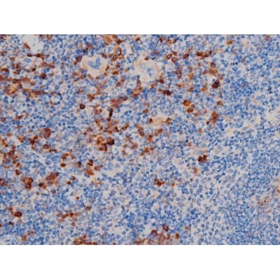 AKT1 Antibody (phospho-Thr450)