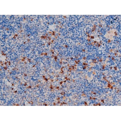 AKT1 Antibody (phospho-Thr450)