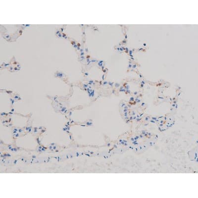 AKT1 Antibody (phospho-Thr450)