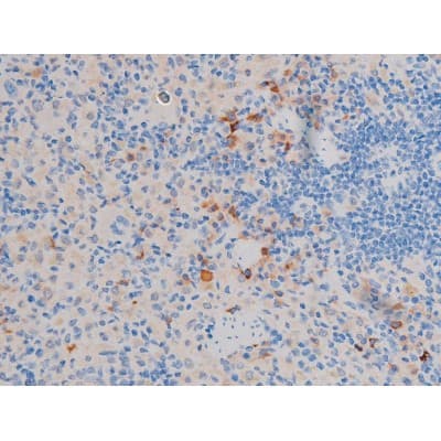 AKT1 Antibody (phospho-Thr450)