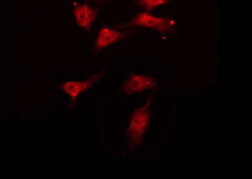 AKT1 Antibody (phospho-Thr450)