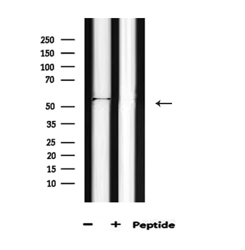 AKT1 Antibody (phospho-Thr450)