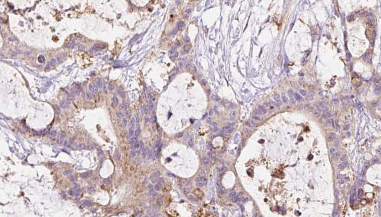 CD144 / CDH5 / VE Cadherin Antibody (phospho-Tyr731)