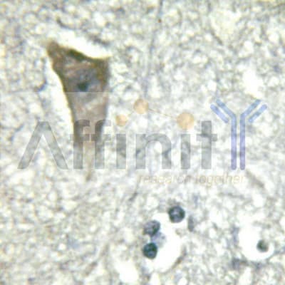 CD144 / CDH5 / VE Cadherin Antibody (phospho-Tyr731)