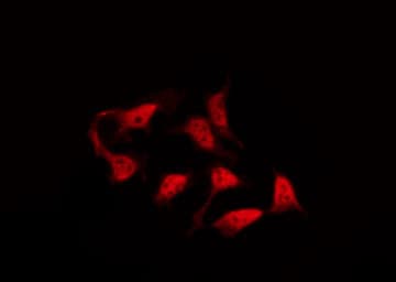 Polyclonal Rabbit anti-Human CTNNB1 / Beta Catenin Antibody (phospho-Ser33, IHC, IF, WB)