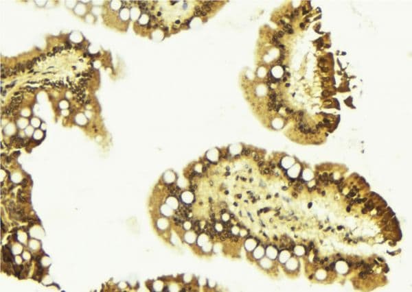 CTNNB1 / Beta Catenin Antibody (phospho-Tyr489)