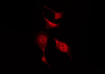 CTNNB1 / Beta Catenin Antibody (phospho-Tyr489)
