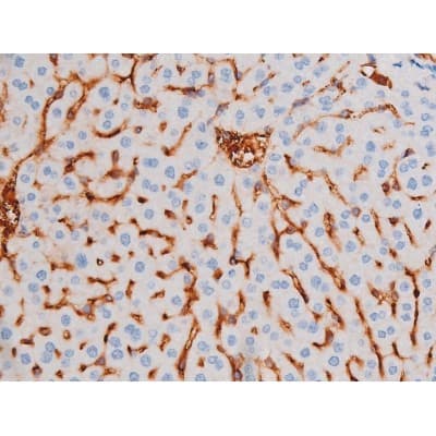 IRS1 Antibody (phospho-Ser312)