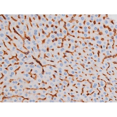IRS1 Antibody (phospho-Ser312)