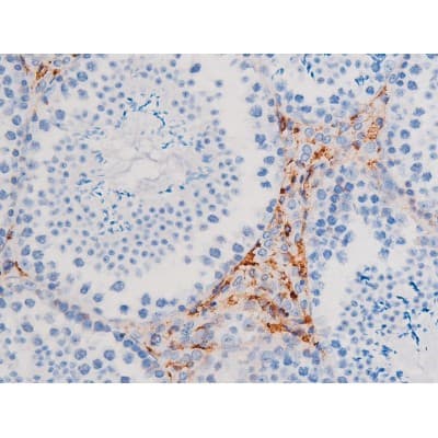 IRS1 Antibody (phospho-Ser312)