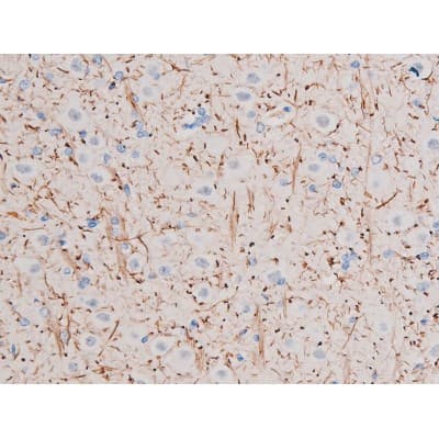 IRS1 Antibody (phospho-Ser312)
