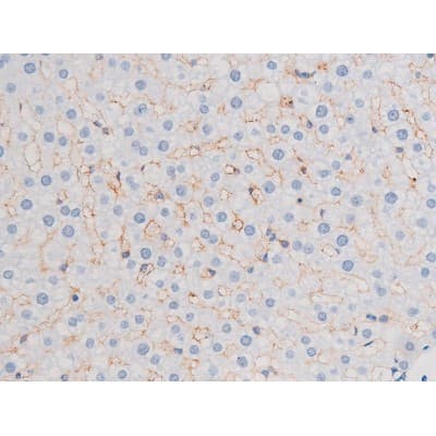 IRS1 Antibody (phospho-Ser312)