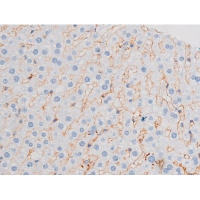 IRS1 Antibody (phospho-Ser312)