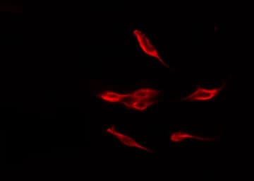 IRS1 Antibody (phospho-Ser312)