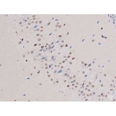 Polyclonal Rabbit anti-Human IRS1 Antibody (phospho-Ser636, IHC, IF, WB)