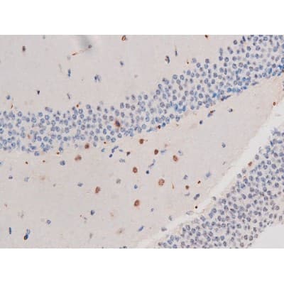 Polyclonal Rabbit anti-Human IRS1 Antibody (phospho-Ser636, IHC, IF, WB)