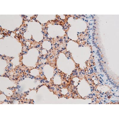 Polyclonal Rabbit anti-Human IRS1 Antibody (phospho-Ser636, IHC, IF, WB)