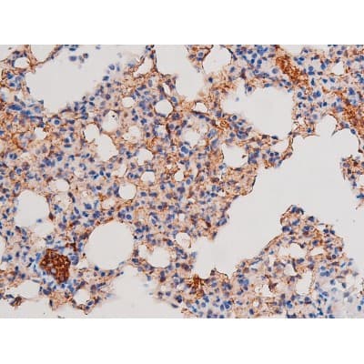 Polyclonal Rabbit anti-Human IRS1 Antibody (phospho-Ser636, IHC, IF, WB)