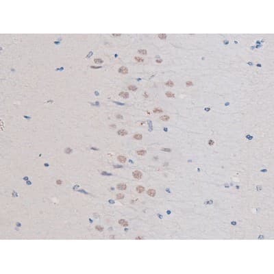 Polyclonal Rabbit anti-Human IRS1 Antibody (phospho-Ser636, IHC, IF, WB)
