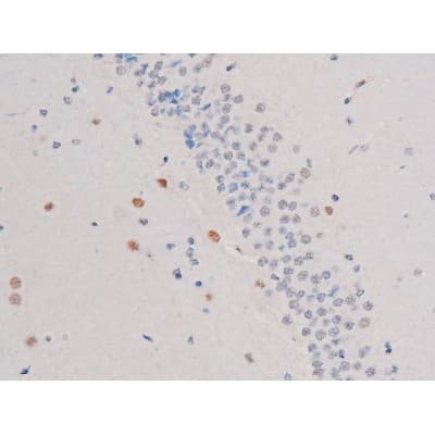 Polyclonal Rabbit anti-Human IRS1 Antibody (phospho-Ser636, IHC, IF, WB)