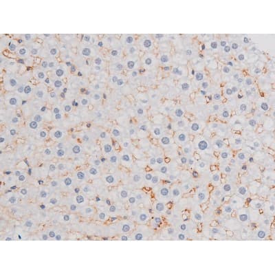 Polyclonal Rabbit anti-Human IRS1 Antibody (phospho-Ser636, IHC, IF, WB)