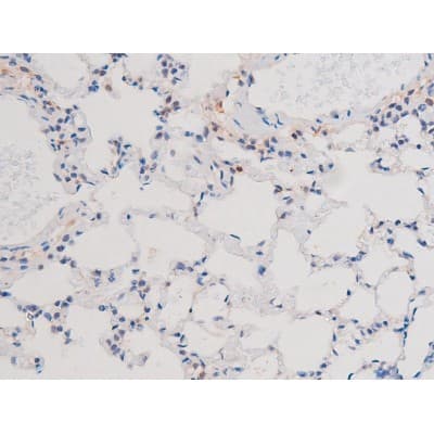 Polyclonal Rabbit anti-Human IRS1 Antibody (phospho-Ser636, IHC, IF, WB)