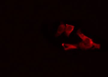Polyclonal Rabbit anti-Human GRIA1 / GLUR1 Antibody (phospho-Ser863, IHC, IF, WB)