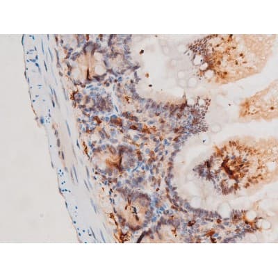 Polyclonal Rabbit anti-Human SYK Antibody (phospho-Tyr525, IHC, IF, WB)