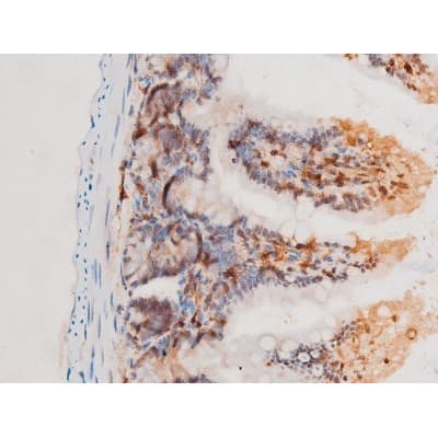 Polyclonal Rabbit anti-Human SYK Antibody (phospho-Tyr525, IHC, IF, WB)