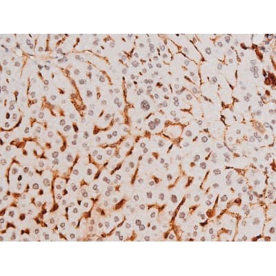 Polyclonal Rabbit anti-Human SYK Antibody (phospho-Tyr525, IHC, IF, WB)
