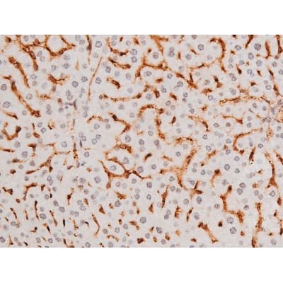 Polyclonal Rabbit anti-Human SYK Antibody (phospho-Tyr525, IHC, IF, WB)