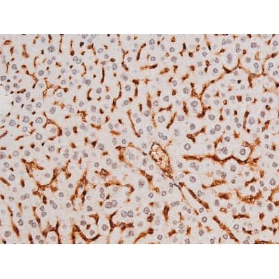 Polyclonal Rabbit anti-Human SYK Antibody (phospho-Tyr525, IHC, IF, WB)