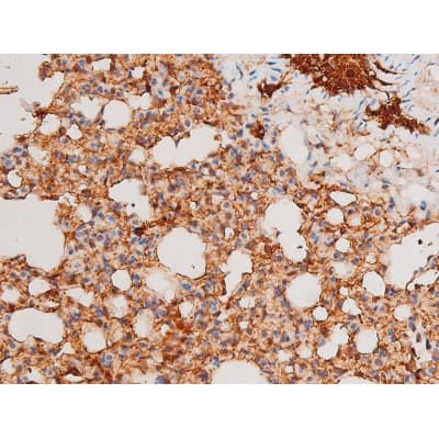 Polyclonal Rabbit anti-Human SYK Antibody (phospho-Tyr525, IHC, IF, WB)