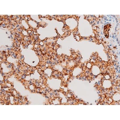 Polyclonal Rabbit anti-Human SYK Antibody (phospho-Tyr525, IHC, IF, WB)