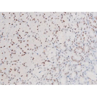 Polyclonal Rabbit anti-Human SYK Antibody (phospho-Tyr525, IHC, IF, WB)