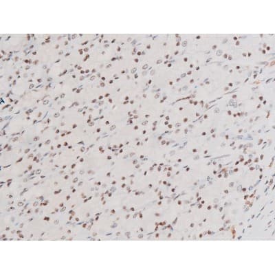 Polyclonal Rabbit anti-Human SYK Antibody (phospho-Tyr525, IHC, IF, WB)