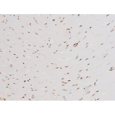 Polyclonal Rabbit anti-Human SYK Antibody (phospho-Tyr525, IHC, IF, WB)
