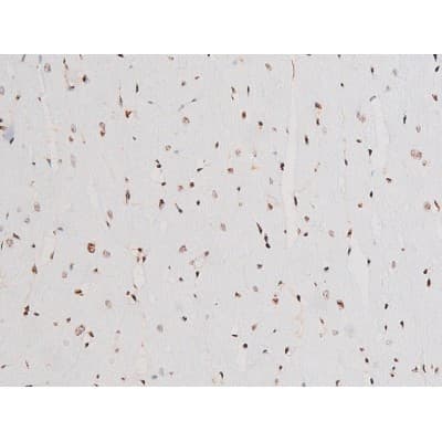 Polyclonal Rabbit anti-Human SYK Antibody (phospho-Tyr525, IHC, IF, WB)