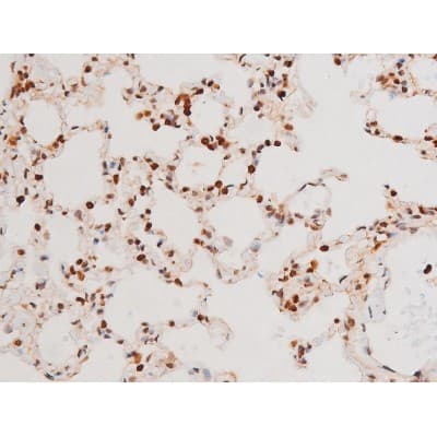 Polyclonal Rabbit anti-Human SYK Antibody (phospho-Tyr525, IHC, IF, WB)