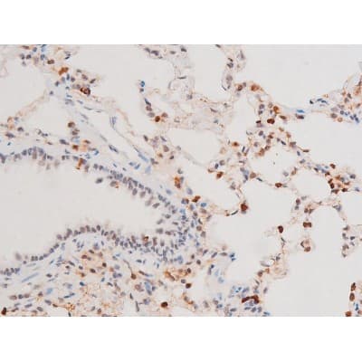 Polyclonal Rabbit anti-Human SYK Antibody (phospho-Tyr525, IHC, IF, WB)