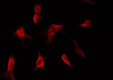 Polyclonal Rabbit anti-Human SYK Antibody (phospho-Tyr525, IHC, IF, WB)