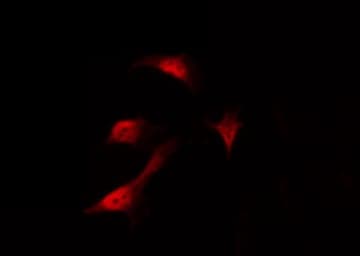 Polyclonal Rabbit anti-Human C/EBP Alpha / CEBPA Antibody (phospho-Ser21, IHC, IF, WB)