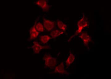 Polyclonal Rabbit anti-Human Tuberin / TSC2 Antibody (phospho-Thr1462, IHC, IF, WB)