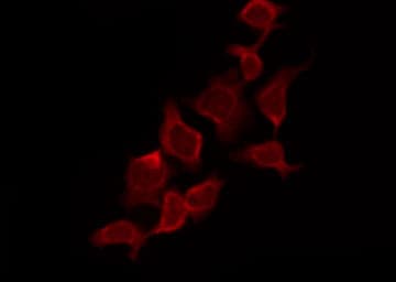 Polyclonal Rabbit anti-Human CASP9 / Caspase 9 Antibody (phospho-Thr125, IHC, IF, WB)