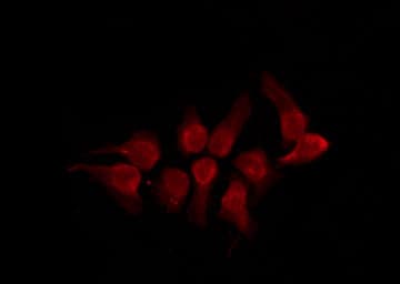 Polyclonal Rabbit anti-Human SMAD3 Antibody (phospho-Thr179, IHC, IF, WB)