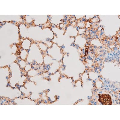 Polyclonal Rabbit anti-Human SMAD3 Antibody (phospho-Thr8, IHC, WB)