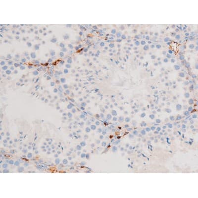 Polyclonal Rabbit anti-Human SMAD3 Antibody (phospho-Thr8, IHC, WB)